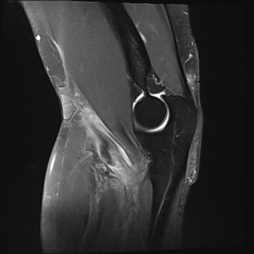 Click on the Serie image to view the images of Wieszt, Gnter